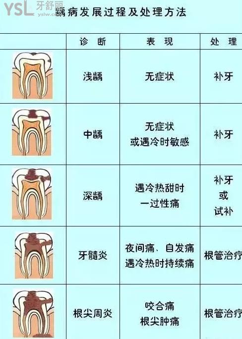 牙齿根管分布图解图片