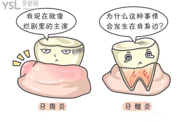 牙周炎和牙髓炎