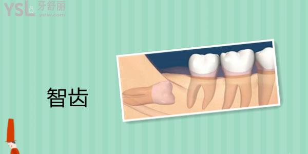 牙龈肿痛是什么原因引起的 该如何改善呢