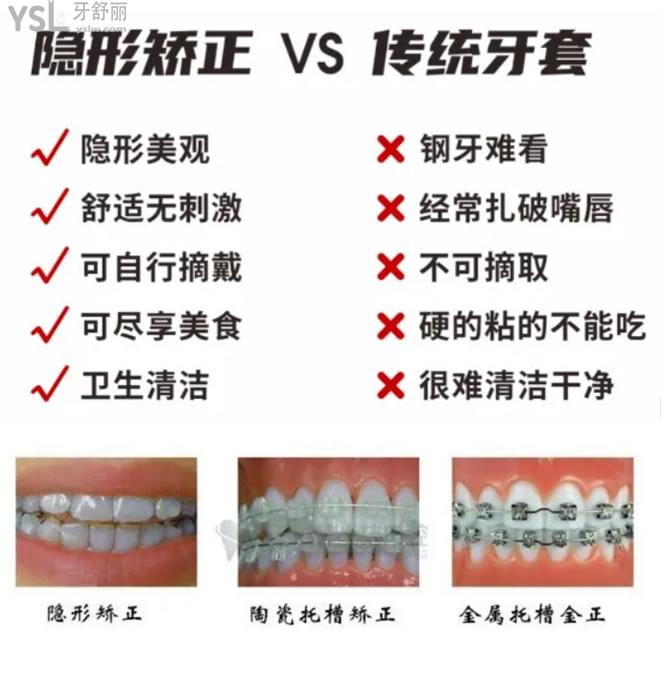 矫正牙齿价目表 正畸图片