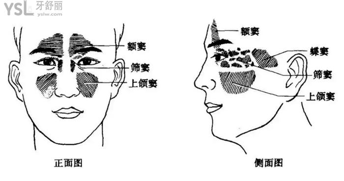 上颌窦图