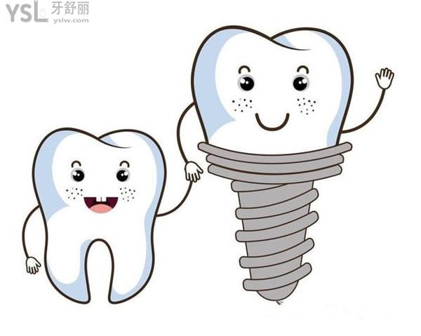 种植牙卡通图