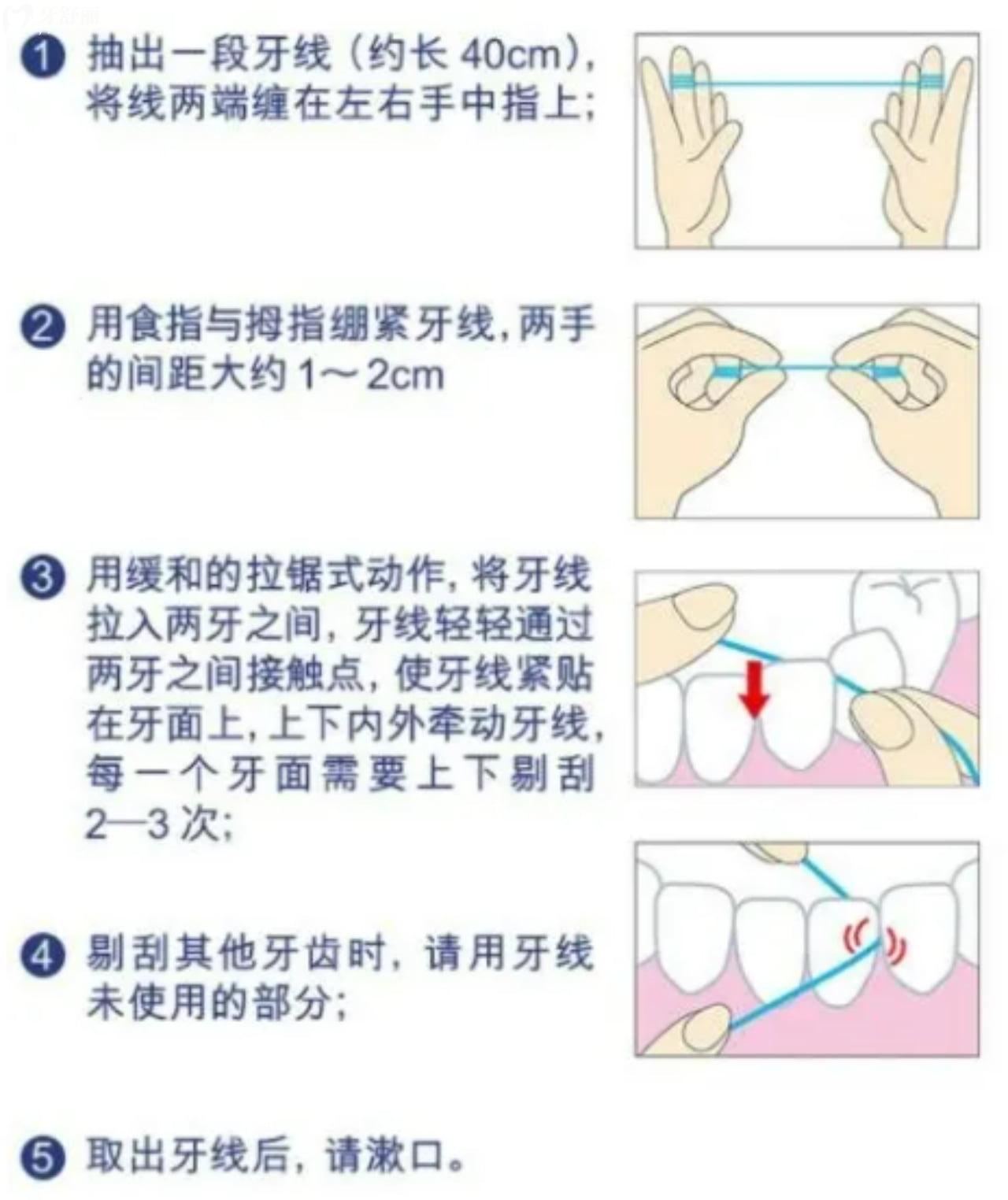 牙线用多了牙龈肿痛怎么回事？可能你不知道牙线正确使用法！_“牙舒丽网