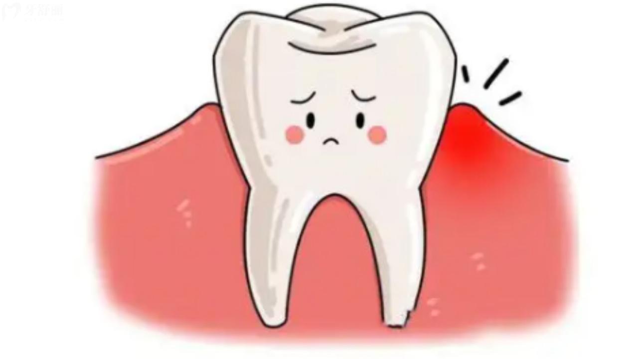 牙龈肿了个肉坨怎么办?有什么消肿的好办法?