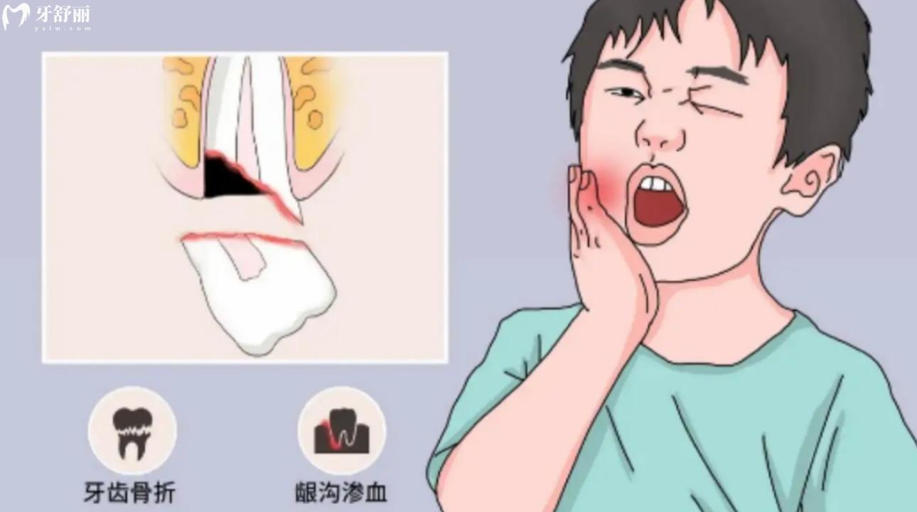 牙龈松动肿痛怎么办?吃黄连/鱼腥草可以缓解吗?