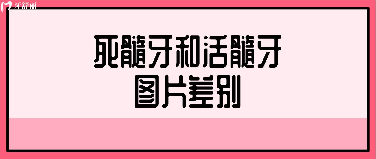 死髓牙和活髓牙图片图片