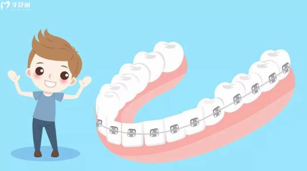 牙齿反弹重新整需要多久?二次矫正对牙齿伤害大吗?