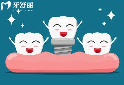广州种植牙多少钱一颗2023年