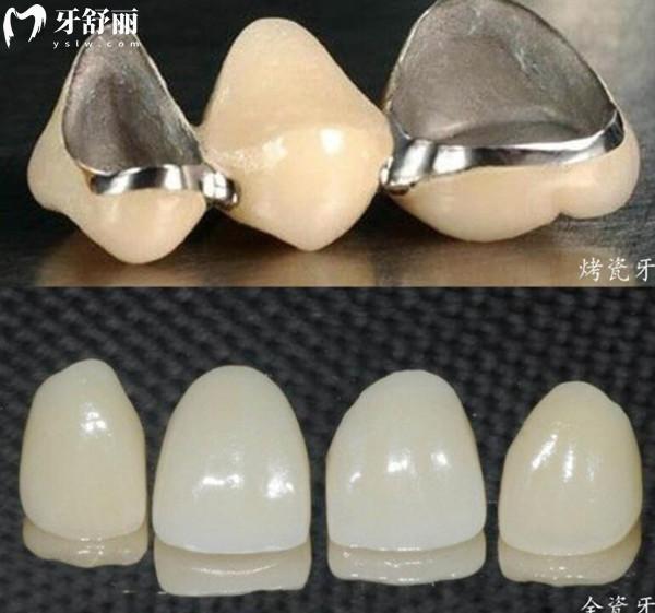 新版苏州口腔医院收费标准,查询牙齿种植3000矫正6000烤瓷牙500