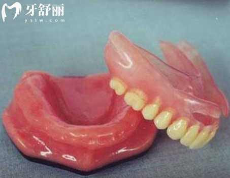 吸附性义齿和普通义齿有啥区别