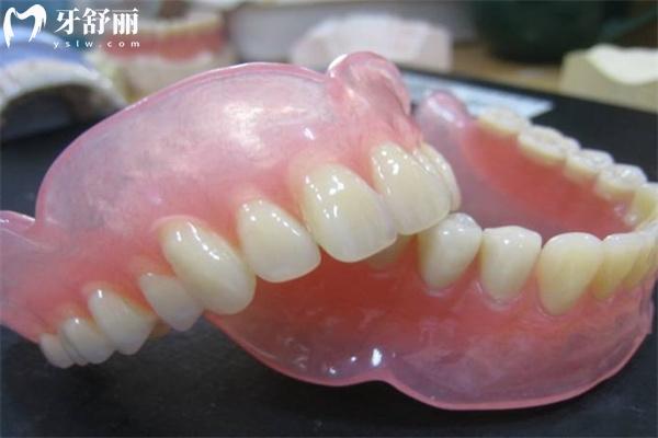 吸附性义齿需要什么条件才能戴?对比普通义齿有啥区别价格多少钱?