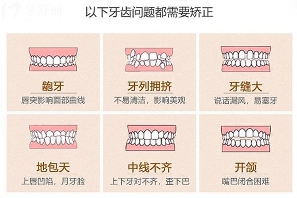 牙齿畸形形成的原因有哪些