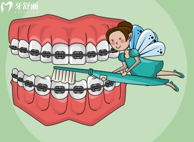 孩子戴牙套时该如何护理?做到这几点轻松度过牙齿矫正期
