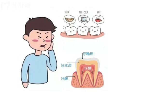 牙神经为什么会外露？症状＋治疗＋预防一文了解