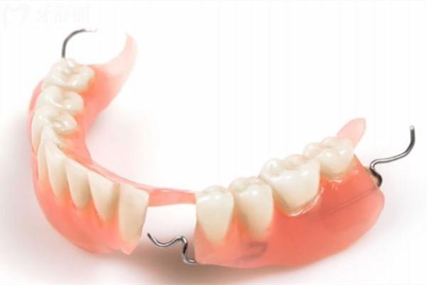 挂钩假牙和隐形义齿的区别在哪里
