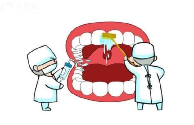 牙周袋怎么治疗有效