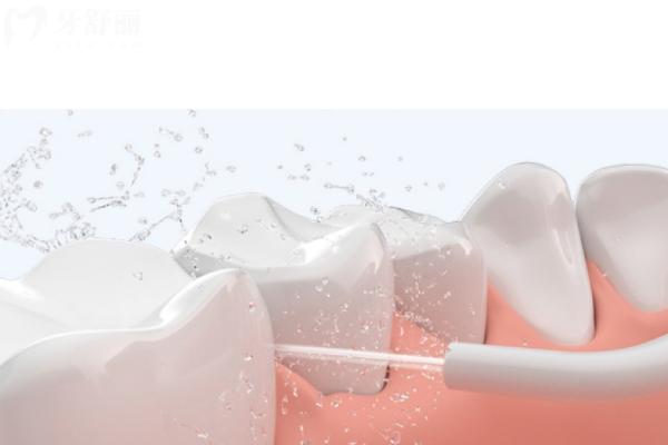 牙医为什么推荐用冲牙器？做到清洁到位才可以保护口腔