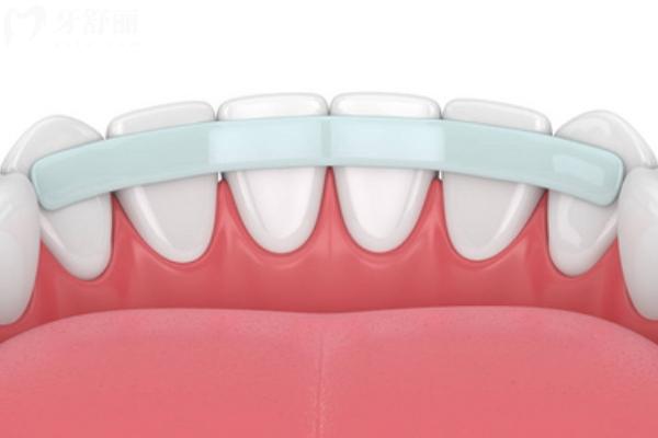 牙齿松动能自己长好吗？