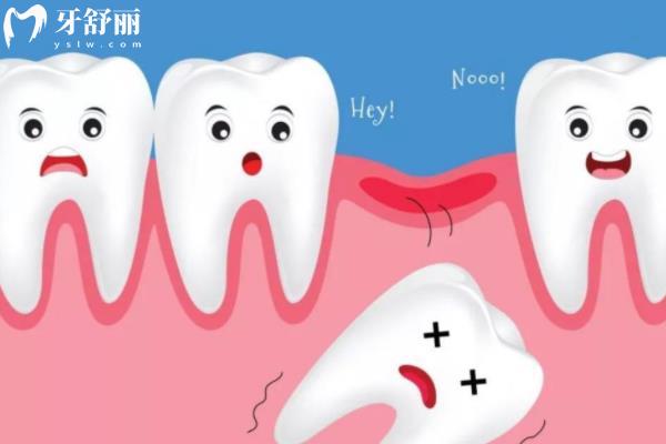 牙齿松动能自己长好吗？
