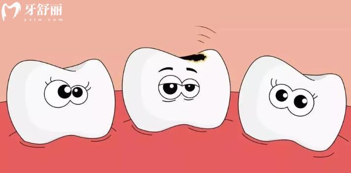 学前儿童如何保护牙齿预防龋齿