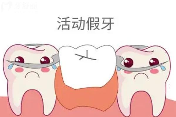 全口假牙必须把原来牙齿拔光吗？
