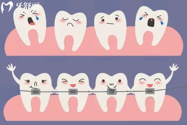 几颗牙齿可以矫正吗？